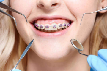 Tollgate Orthodontics