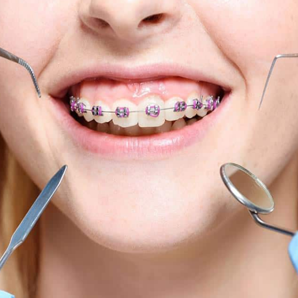 Tollgate Orthodontics